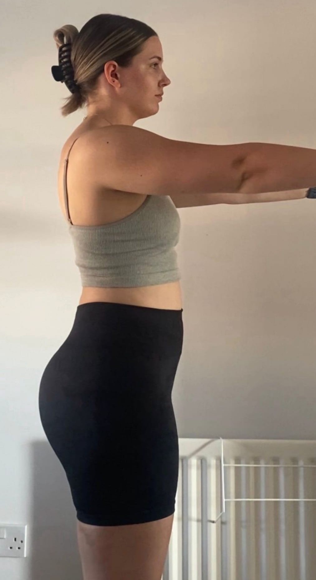 Emma - Before 2